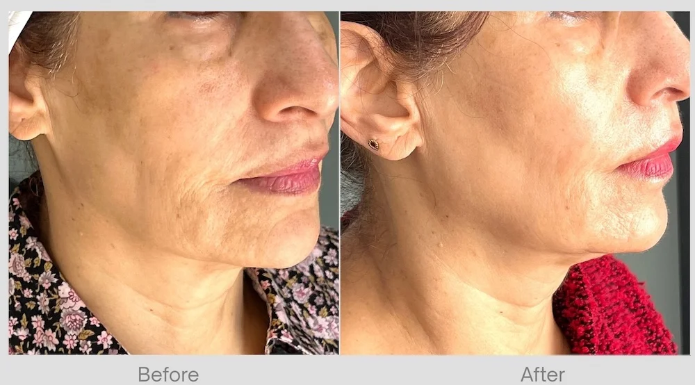 SkinVive Before & After for Mature Skin Glow