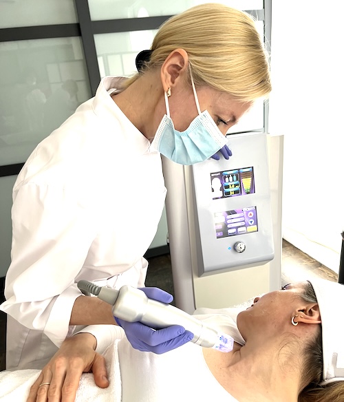 Sylfirm X RF microneedling tightening the jawline without fat loss – suitable for mature and slender faces