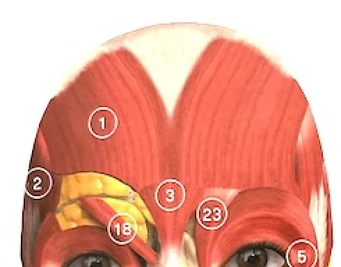 Botox treatment areas with different injection depths and muscle anatomy
