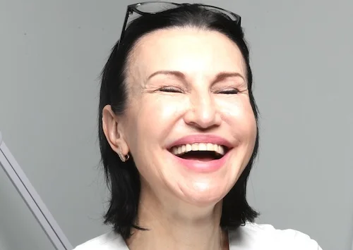 Woman smiling with natural crow's feet before Botox treatment in Toronto