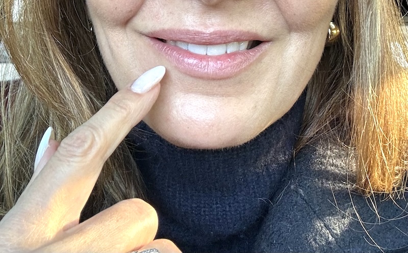 Botox Side Effects in Toronto – What to Expect After Treatment