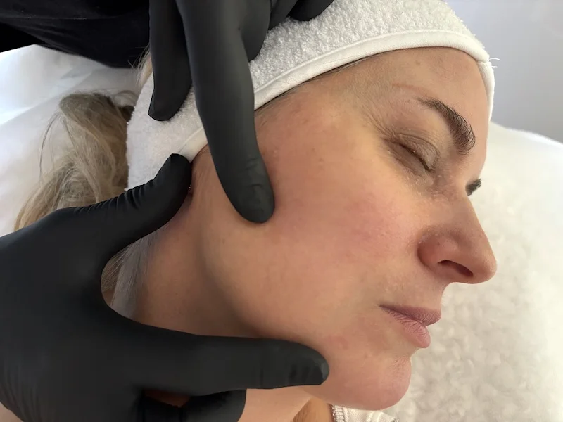 Assessment of jawline volume loss and facial support in a mature client