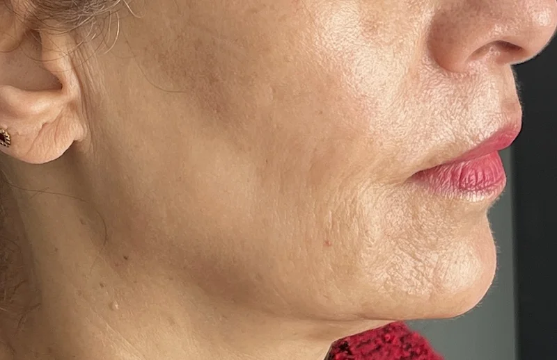 SkinVive for smooth and even skin