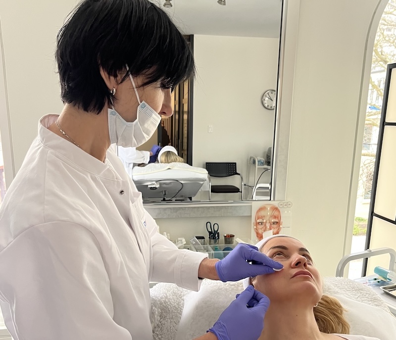 Cannula technique for Skinvive dermal filler injections Canula technique Skinvive injections Toronto