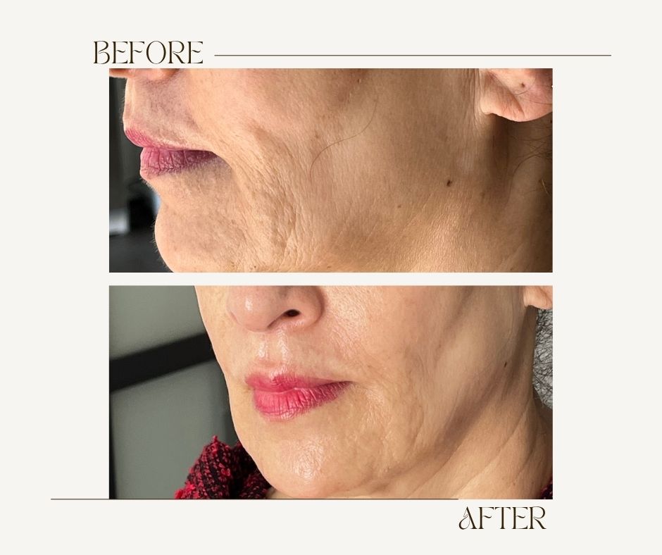 How skin texture defines perceived age more than facial shape Diagram showing how smooth skin texture influences youthful appearance more than facial structure