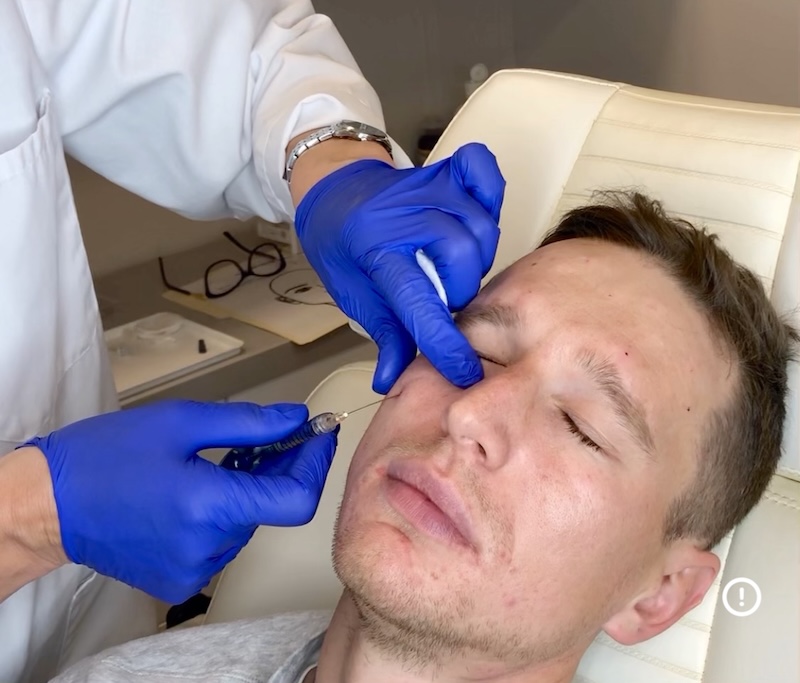 Experienced injector performing under eye filler at MedVSPA in Yorkville Toronto