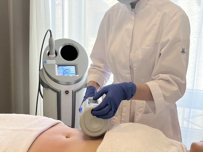 Endospheres therapy cost and benefits concept in Toronto clinic setting