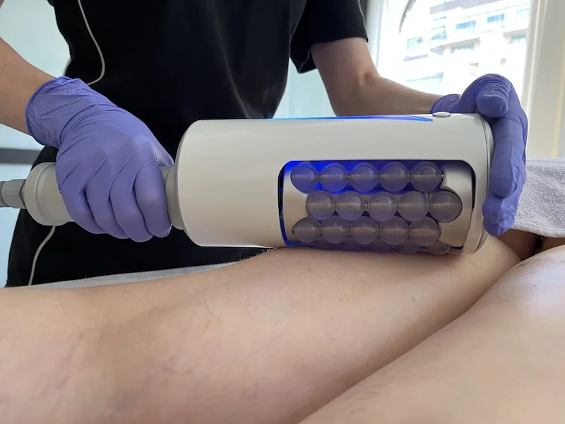 Endospheres Therapy device micro vibration compression spheres