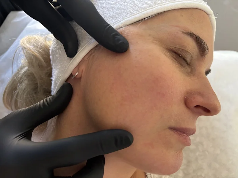 Assessment of facial support and jawline in a mature client