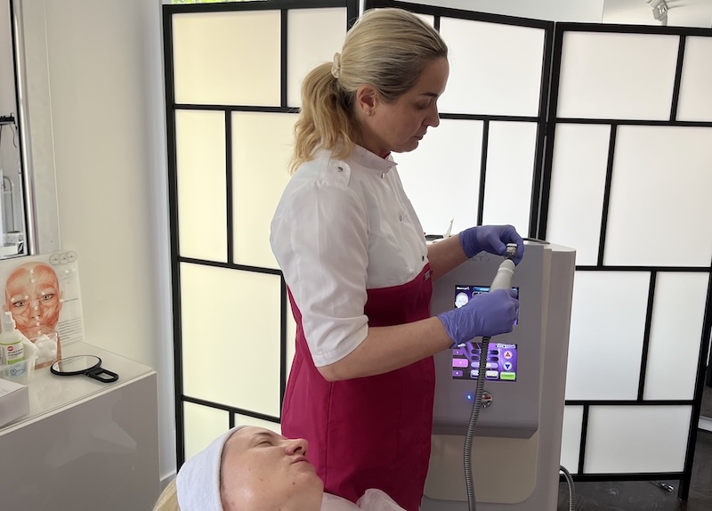 RF Microneedling treatment for menopausal women in Toronto clinic