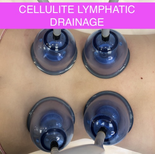 Client receiving lymphatic massage as part of cellulite plan
