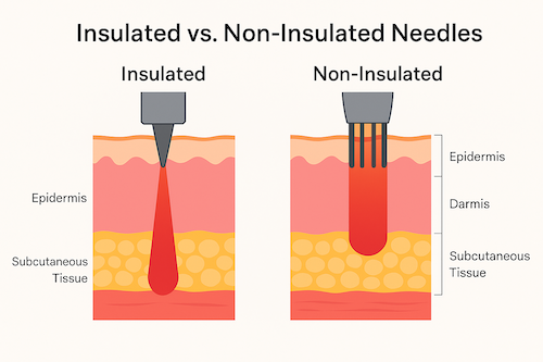 nsulated vs. Non-Insulated RF Microneedling Needles: How They Deliver Energy llustration comparing insulated and non-insulated RF microneedling needles. Insulated needles deliver energy only in the dermis, while non-insulated needles emit RF along the full needle length, affecting both epidermis and dermis