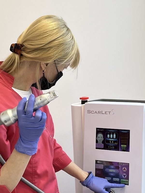 Comparison of RF microneedling device and standard microneedling