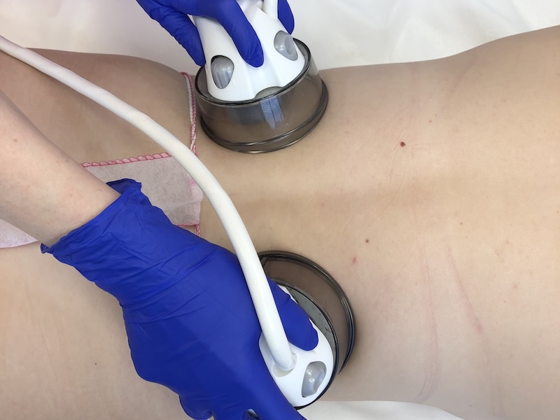 Therapist performing lymphatic drainage focused on detox