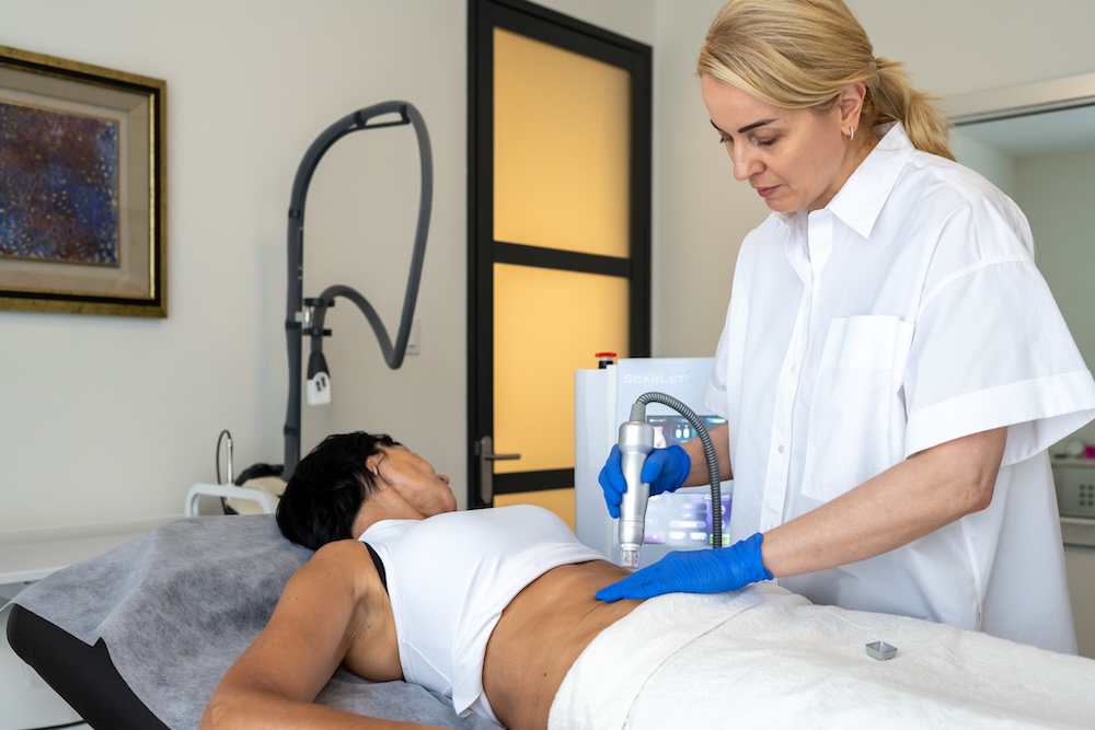 Esthetican preparing RF Microneedling to work on client's abdomen in Toronto